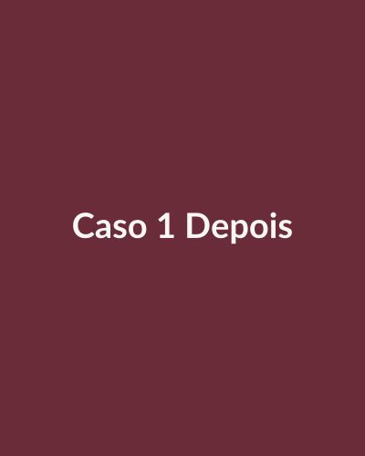 Depois: Preenchimento de olheiras + contorno mandibular
