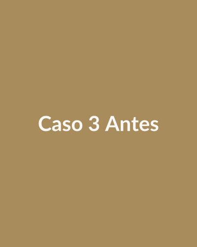 Antes: Bioestimulador de colágeno facial