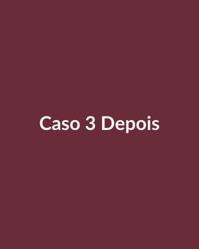 Depois: Bioestimulador de colágeno facial